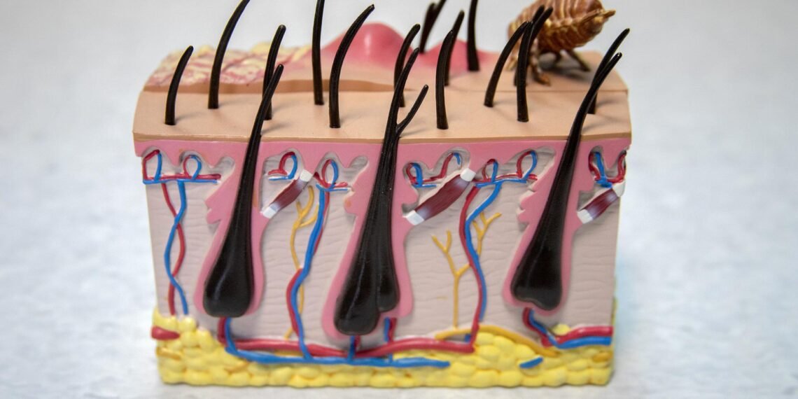 Does Jock Itch Really Go Away? Way Networking